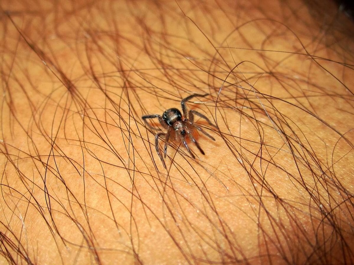 Spider Bites What To Do If You’ve Been Attacked By A Spider