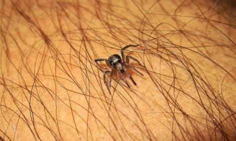 Spider Bites What To Do If You’ve Been Attacked By A Spider