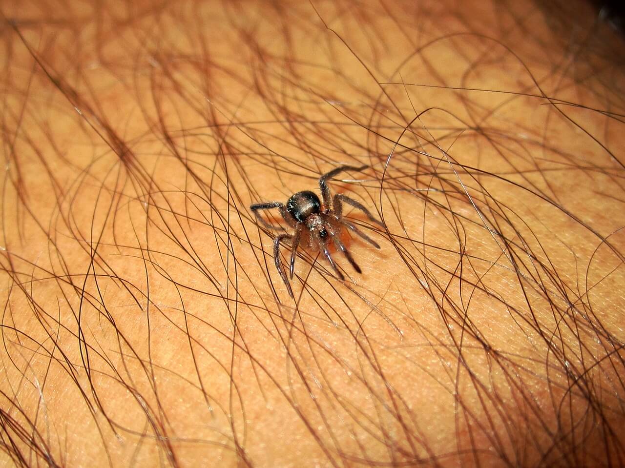 Spider Bites What To Do If You’ve Been Attacked By A Spider