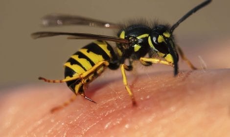 What to Do if You’ve Been Stung by a Wasp or Bee